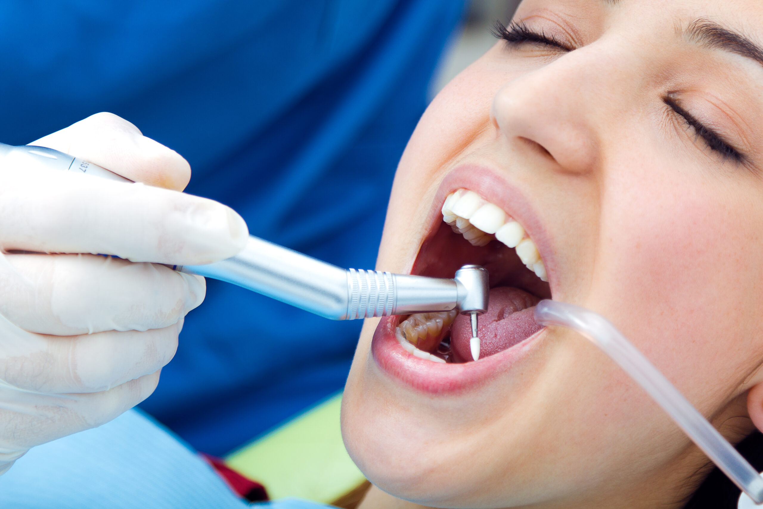 Dental implant procedure in Miami for smile restoration