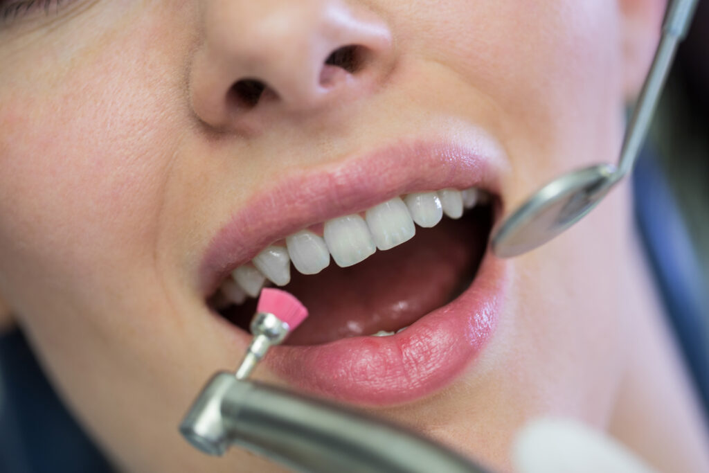 Dental implant procedure in Miami for smile restoration